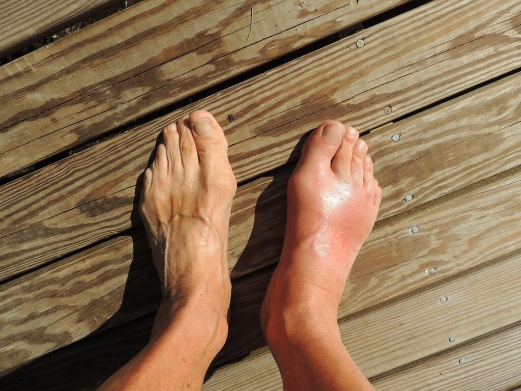 chicken foot swelling